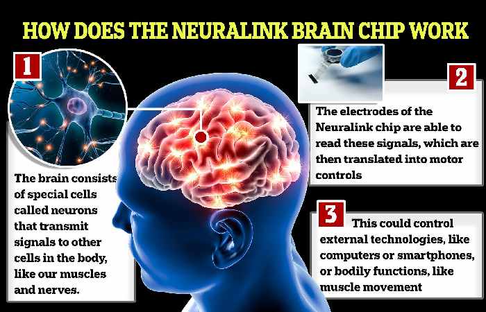 Neuralink Brain Chip: What Does It Do